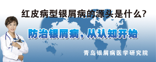 红皮型银屑病的源头是什么
